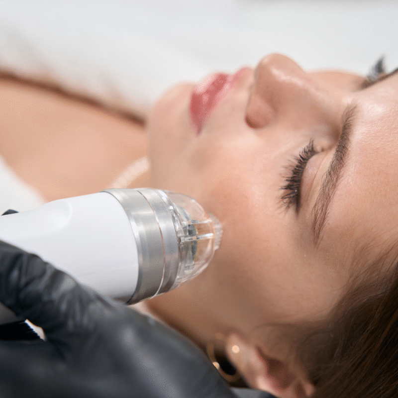 RF mikroigłowa i bezigłowa MEDOFRAX