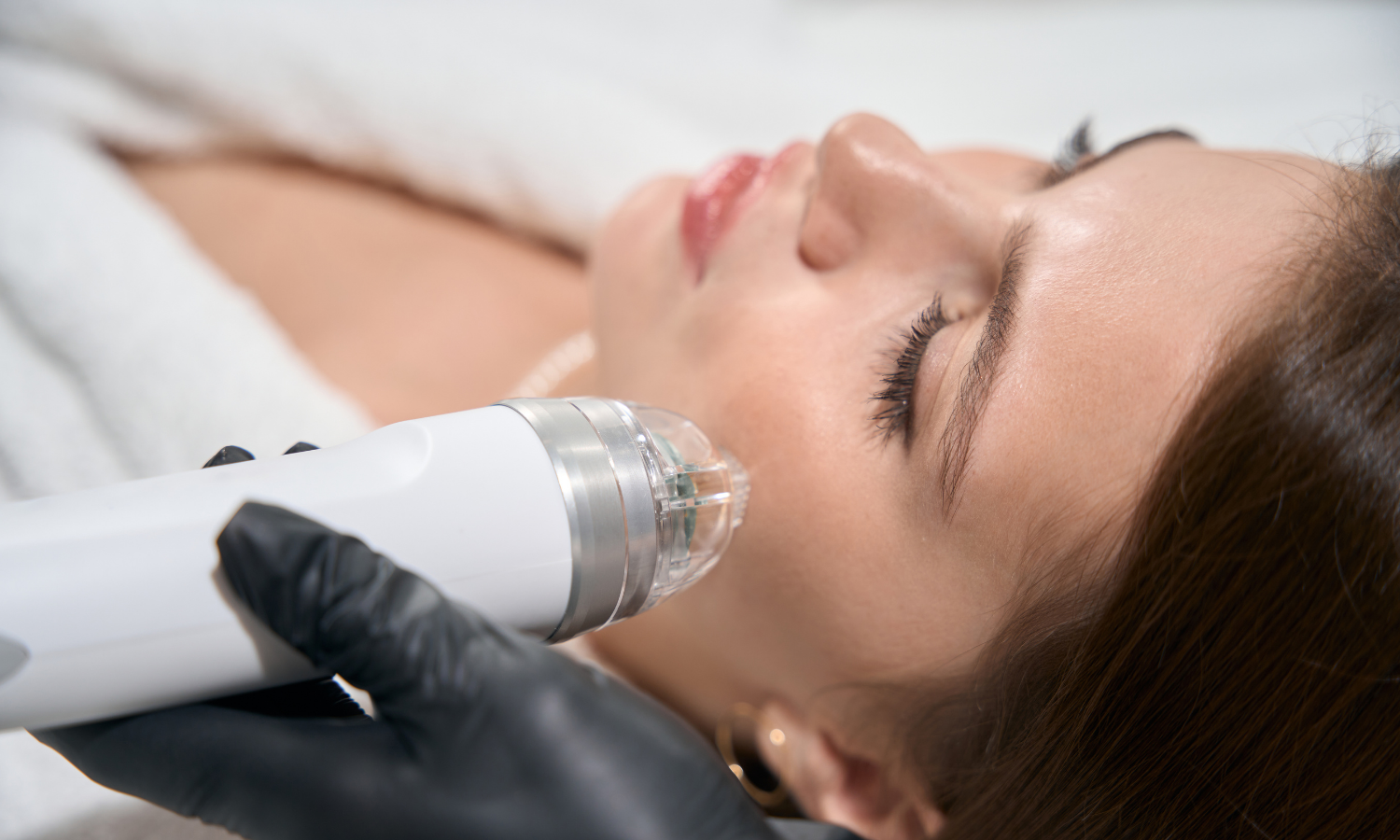 RF mikroigłowa i bezigłowa MEDOFRAX