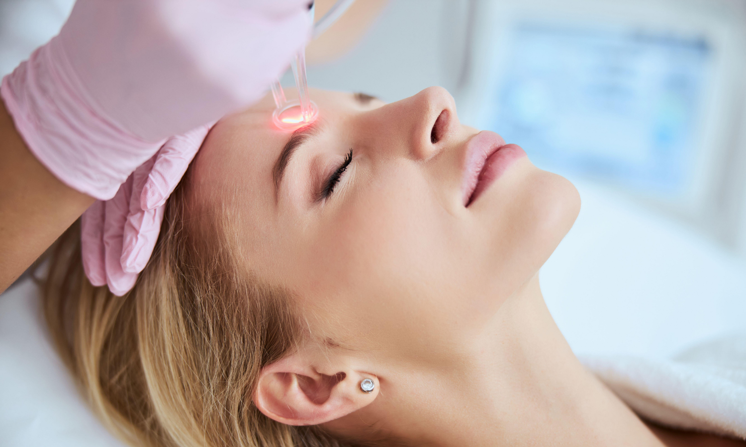 iPixel- resurfacing skór, odmładzanie, redukcja blizn i rozstępów