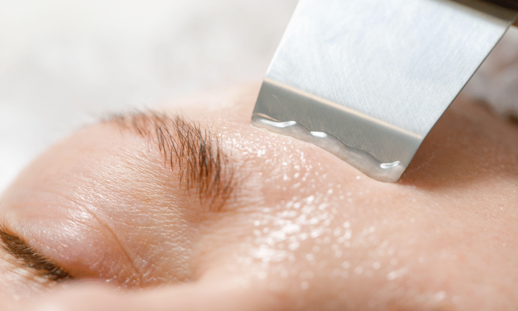 peeling kawitacyjny vs. chemiczny