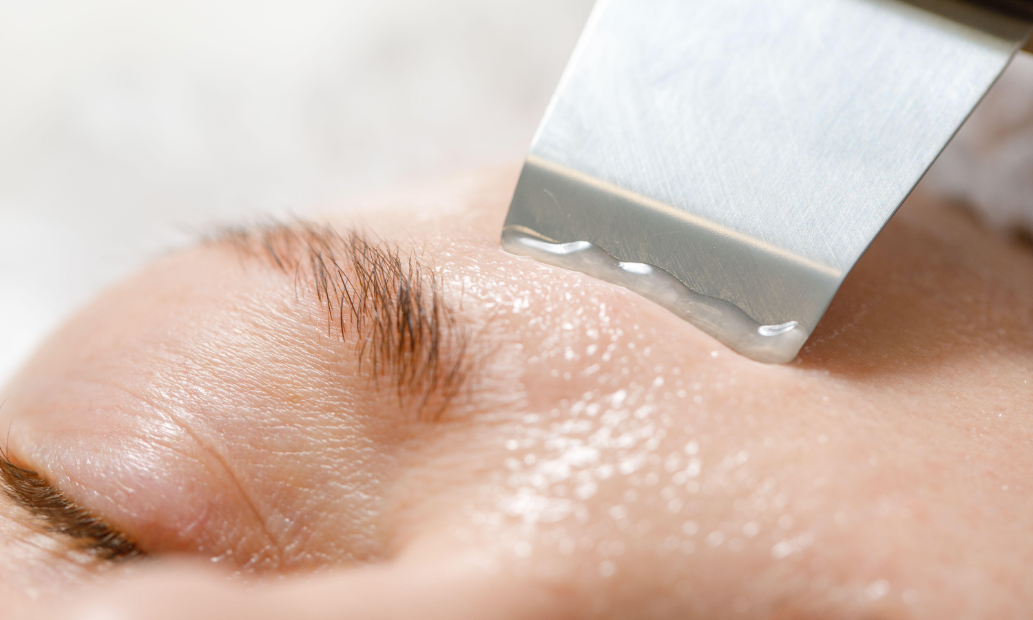 Peeling kawitacyjny czy chemiczny — który wybrać i dla kogo?