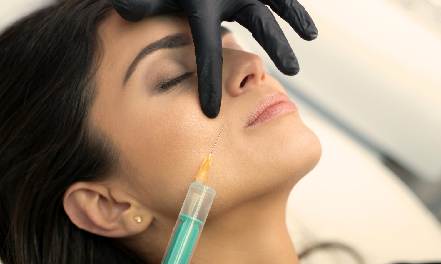 Mezoterapia igłowa — kiedy warto rozpocząć kurację i jakie daje efekty